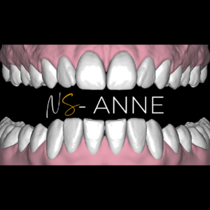 ANNE