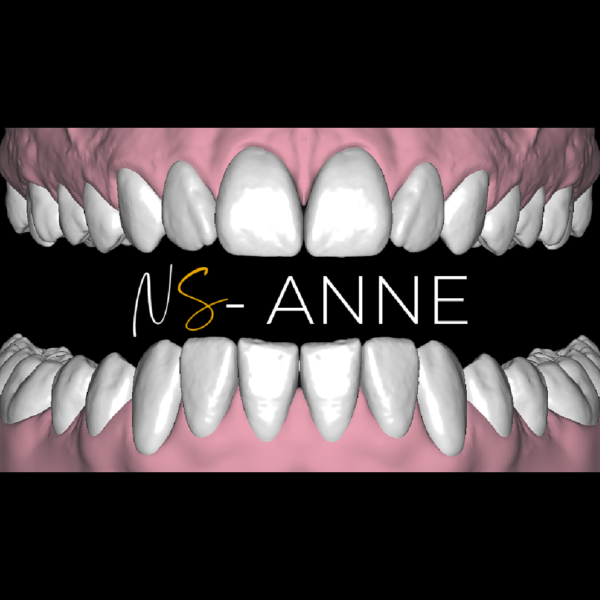 ANNE