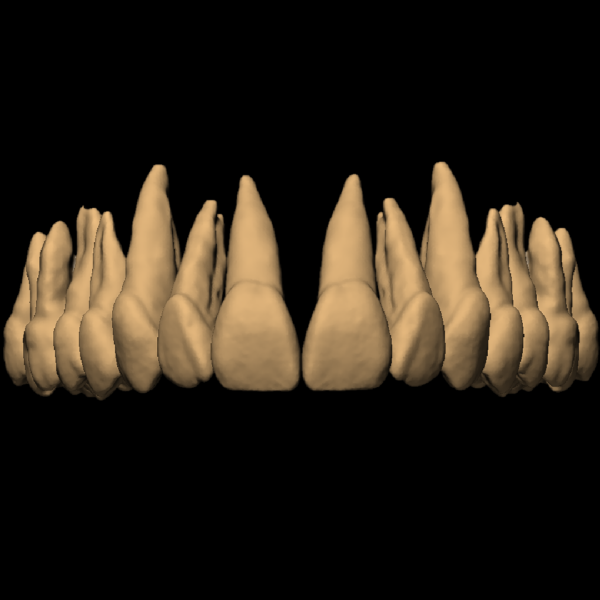 ANNE - Image 2
