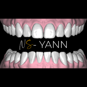 YANN