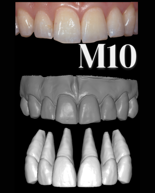 ANTERIORES MALE LIBRARY - Image 11