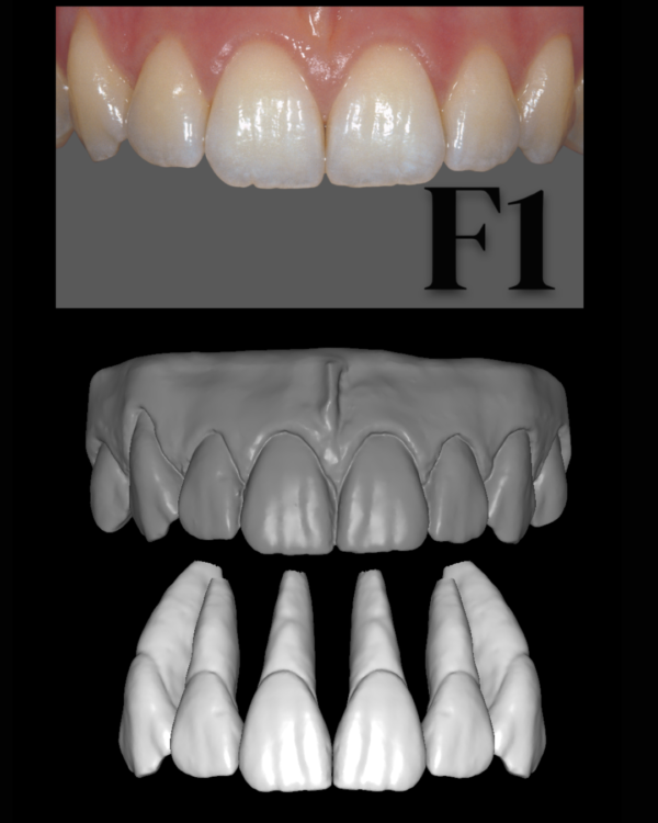 ANTERIORES FEMALE LIBRARY - Image 2