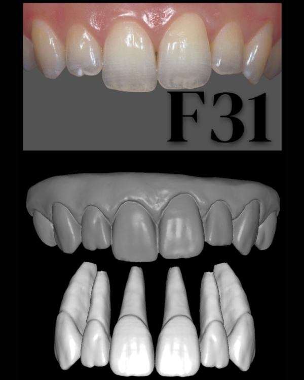 ANTERIORES FEMALE LIBRARY - Image 11