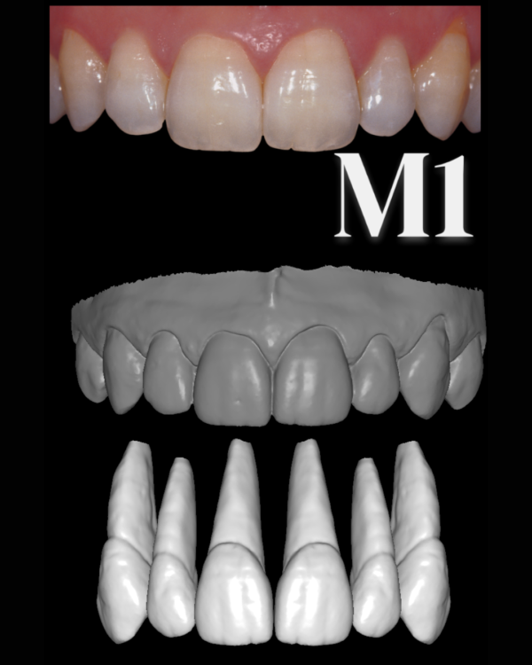 ANTERIORES MALE LIBRARY - Image 2
