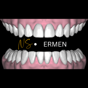 ERMEN